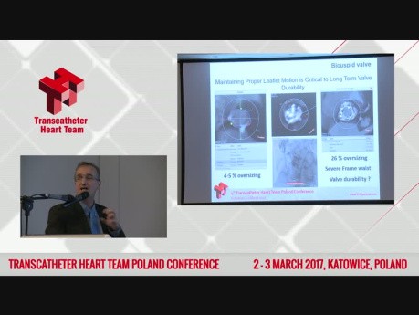 Boston Lotus System TAVI in a Biscuspid Aortic Valve