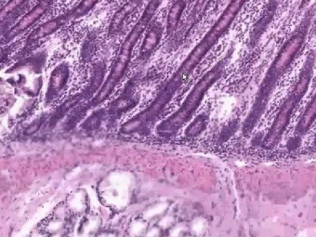 Dwunastnica - histologia