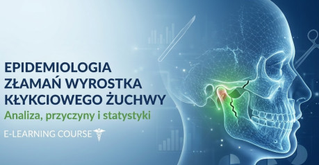 Epidemiologia złamań wyrostka kłykciowego żuchwy