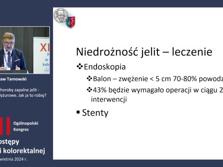 Nieswoiste choroby zapalne jelit - operacje ostro-dyżurowe. Jak ja to robię.