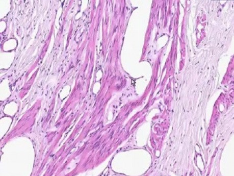 Cewka moczowa u kobiety - histologia