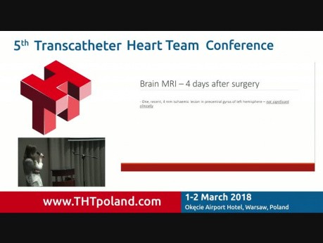 Brain MRI and Health-related Quality of Life Following Transcarotid TAVI Procedure in 80-years Old Patient