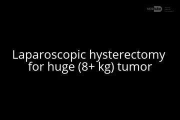 Histerektomia laparoskopowa guza 8+kg