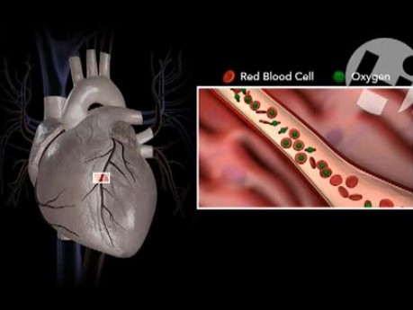 Prawidłowa anatomia i fizjologia naczyń wieńcowych