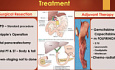 Pancreatic Tumours