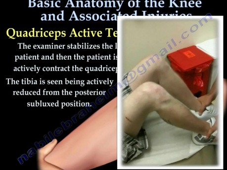 Anatomia kolana i jego urazy