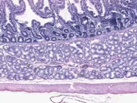 Zespolenie żołądkowo-dwunastnicze - histologia