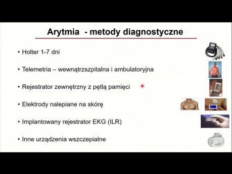 Pacjent z wywiadem nawracających omdleń - Prof. Piotr Kułakowski