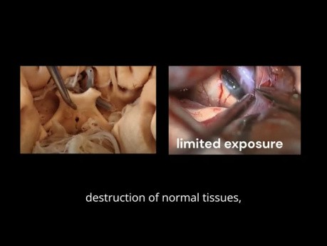 Chirurgiczne wideo dla anatomii