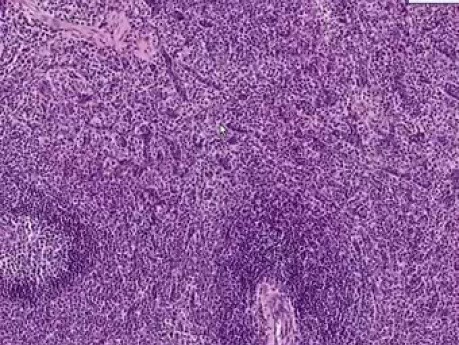 Śledziona - histologia