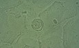Pochwa - Komórki nabłonkowe