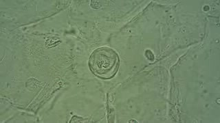 Pochwa - Komórki nabłonkowe