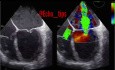 TEE ciężkiej niedomykalności zastawki mitralnej