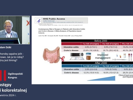 Nieswoiste choroby zapalne jelit - operacja planowe. Jak ja to robię - czy ważny jest timing?