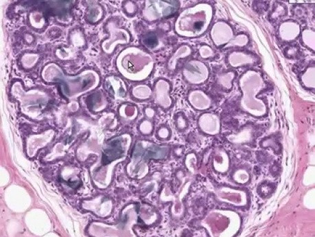 Prawidłowa laktacja - histologia