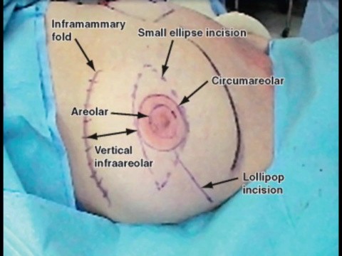 General Surgery 