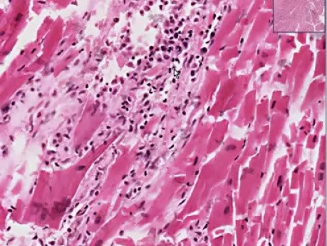 Toxoplasma gondii   