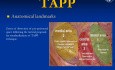 Operacja przepuklin pachwinowych metodą TAPP (wykład)