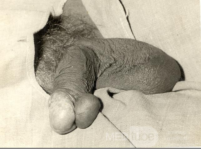 Penis