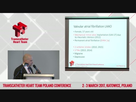 LAAO in Valvular Artial Fibrillation