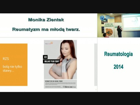 Reumatyzm ma młodą twarz - Monika Zientek