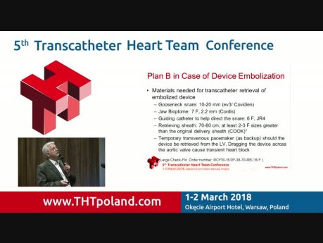 How to Predict and Prevent Difficult LAAO Case Scenarios
