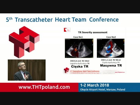 Echocardiography Imaging in Triscupid Valve Regurgitation