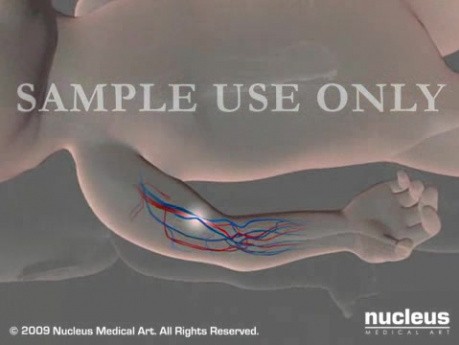 Lokalizacja tętna na tętnicy ramiennej u niemowląt - animacja