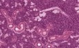 Ślinianka podżuchwowa - histologia