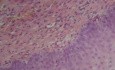 Kanał szyjki macicy - Badanie histopatologiczne