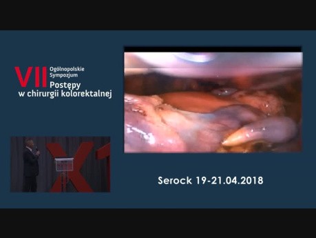 An Unusual (and Potentially Dangerous) Complication During TLH with Lymphadenectomy