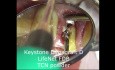 Mikrochirurgia implantologiczna: implantacja naychmiastowa oraz odbudowa tymczasowa