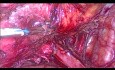 Anatomia więzadła pęcherzowo-macicznego
