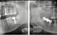 Assesment of Lesion