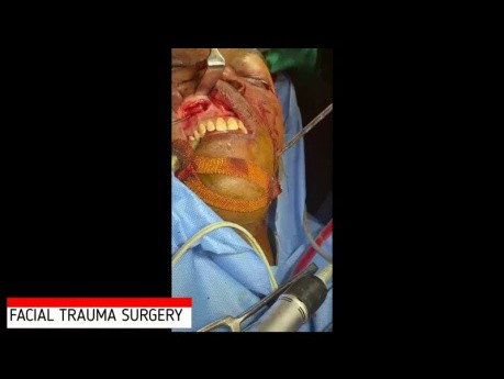 Chirurgia urazowa twarzy