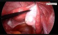 Diagnostyczna laparoskopia, histeroskopia i test na płodność