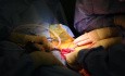 Endoprotezoplastyka stawu biodrowego