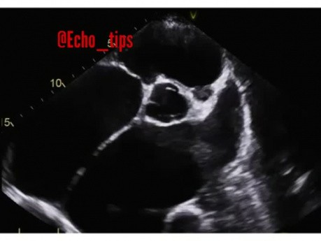 10. Przypadek kardiologiczny - jaka diagnoza?