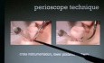 Technika pracy Perioscopem