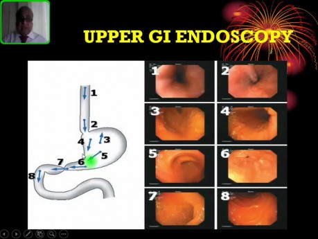 Badanie endoskopowe górnego odcinka przewodu pokarmowego - ogólny zarys