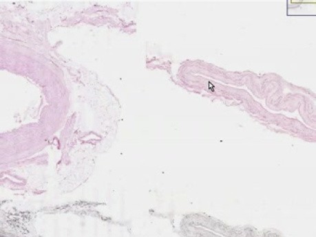 Średnie tętnice i żyły - histologia