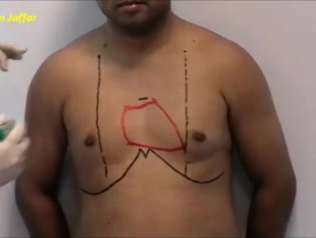 Klatka piersiowa - anatomia 