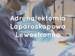 Adrenalektomia Laparoskopowa Lewostronna