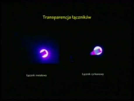 Planowanie i wykonywanie suprastruktury cyrkonowej na implantach z wykorzystaniem tomografii stożkowej - część 2 