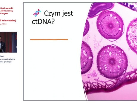 Rola ctDNA w leczeniu uzupełniającym u chorych na raka jelita grubego