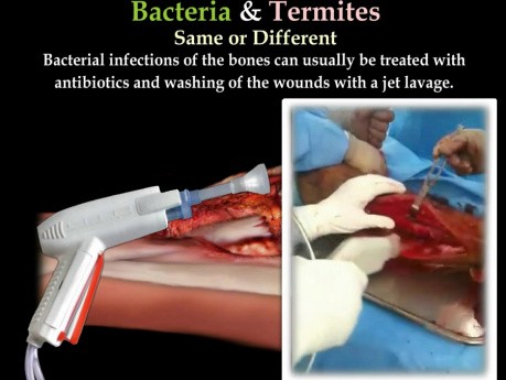 Infekcje bakteryjne, a termity