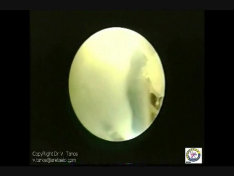 Obserwacja in vivo wczesnego rozwoju embrionu oraz oatczającego go podścieliska.