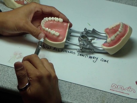 Jak znieczulić zęby od strony podniebiennej bez znieczulania nerwu podniebiennego?