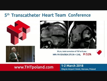 Patient Selection to Pulmonary Artery Valve Transcatheter Implantation