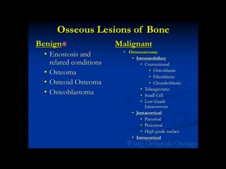 Kurs z ortopedii onkologicznej – łagodne nowotwory kości (kostniak zarodkowy, kostniak kostninowy) – wykład 3